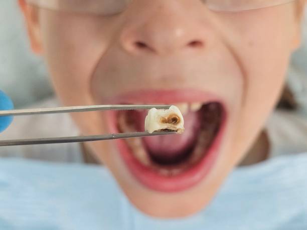 Best Emergency Orthodontic Repairs in Califon, NJ